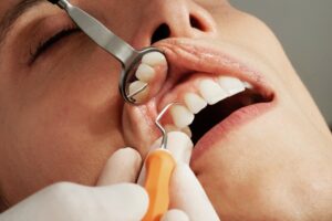 Dentist checking for gum recession.