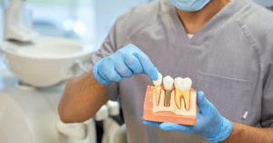 dentist holding a model of teeth displaying dental implants in preparation for a patient appointment