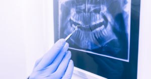 dentist or dental hygienist holding a dental instrument reviewing an x-ray for a patient