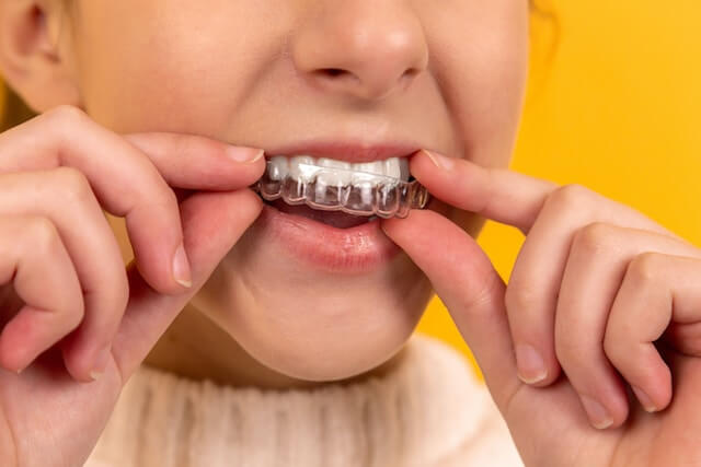 Woman inserts invisalign mold into her mouth as part of her cosmetic dental procedure at Cedarwood Dentistry.