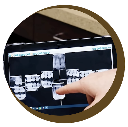 reviewing xrays at Cedarwood Dentistry