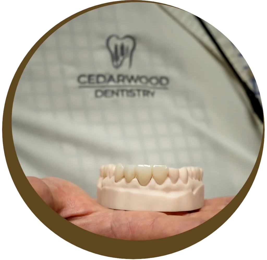Model of teeth at Cedarwood Dentistry in Midlothian